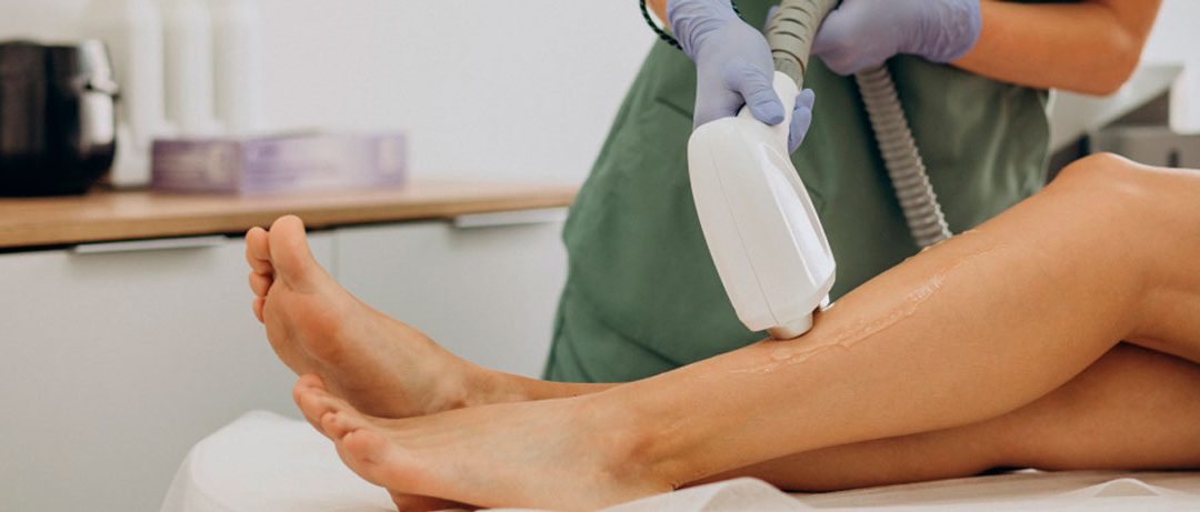 5 Beneficios de la Depilación Definitiva: Dile Adiós al Vello No Deseado