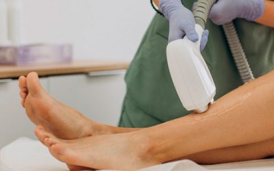 5 Beneficios de la Depilación Definitiva: Dile Adiós al Vello No Deseado